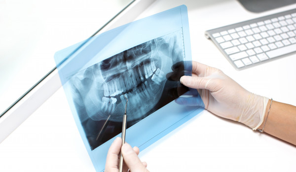 Cirugía Maxilofacial