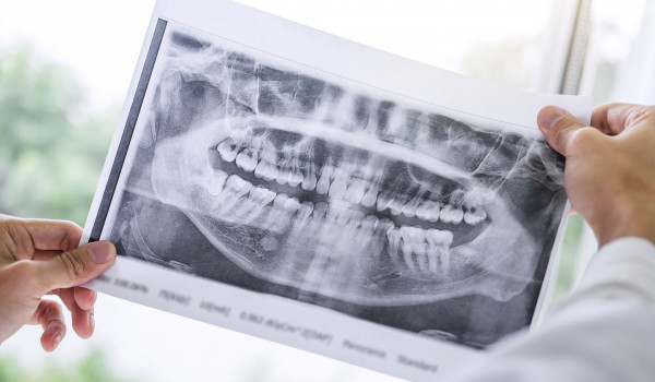 Cirugía Maxilofacial 